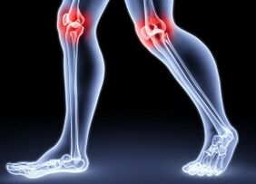 Reasons for the development of knee artrosis